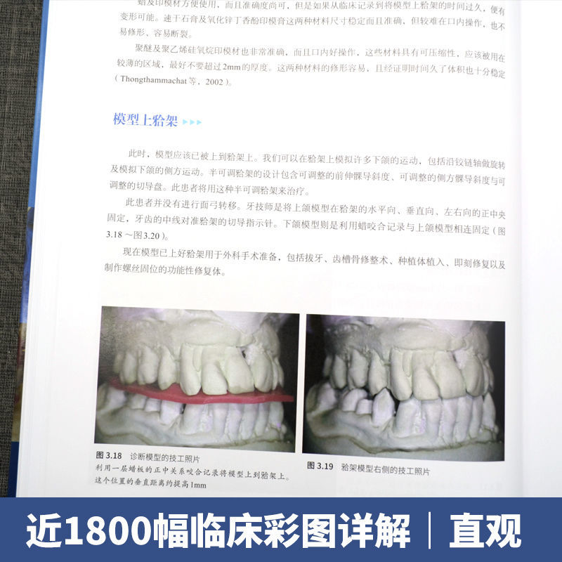 口腔精萃系列--口腔種植工藝操作流程：分步驟操作指南