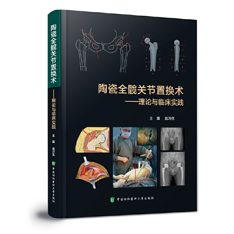 2023新書推薦：陶瓷全髖關節置換術——理論與臨床實踐
