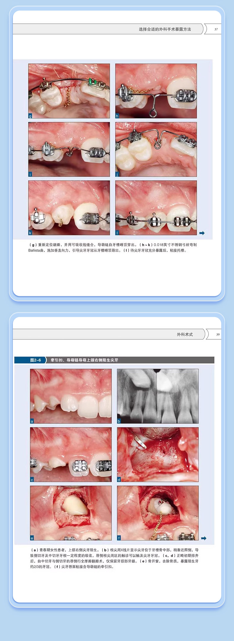 详情5.jpg